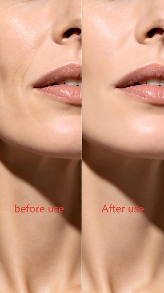 Red Light Neck Tightening Device